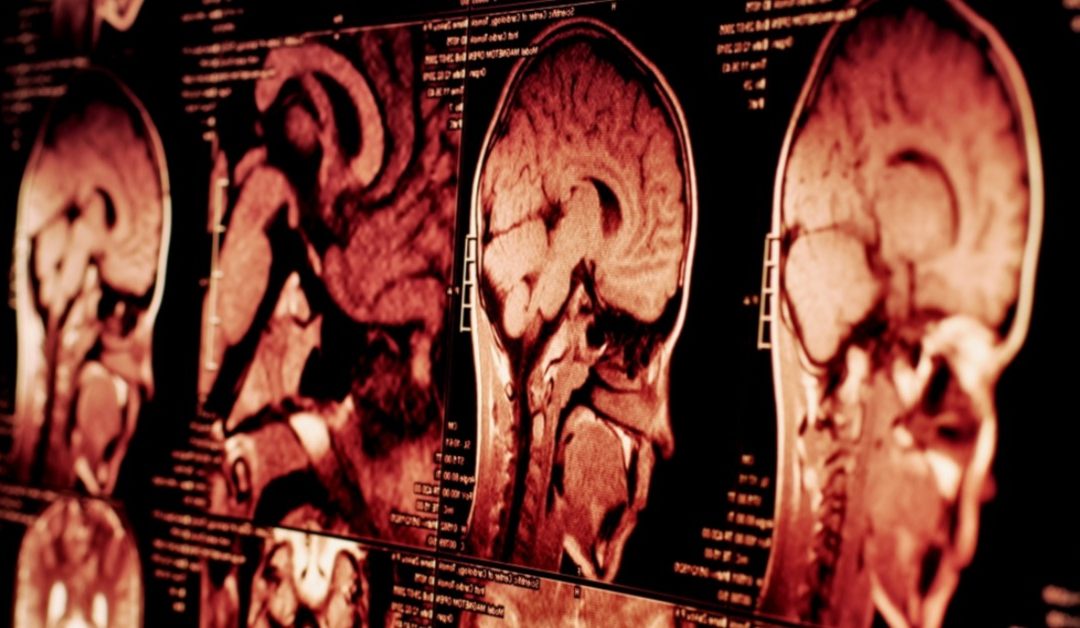 How does the brain heal after trauma?