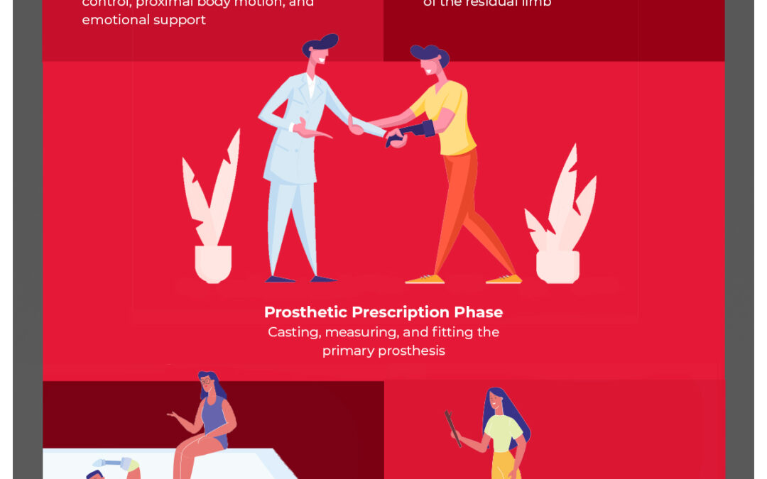 Stages Of Rehab After Limb Loss