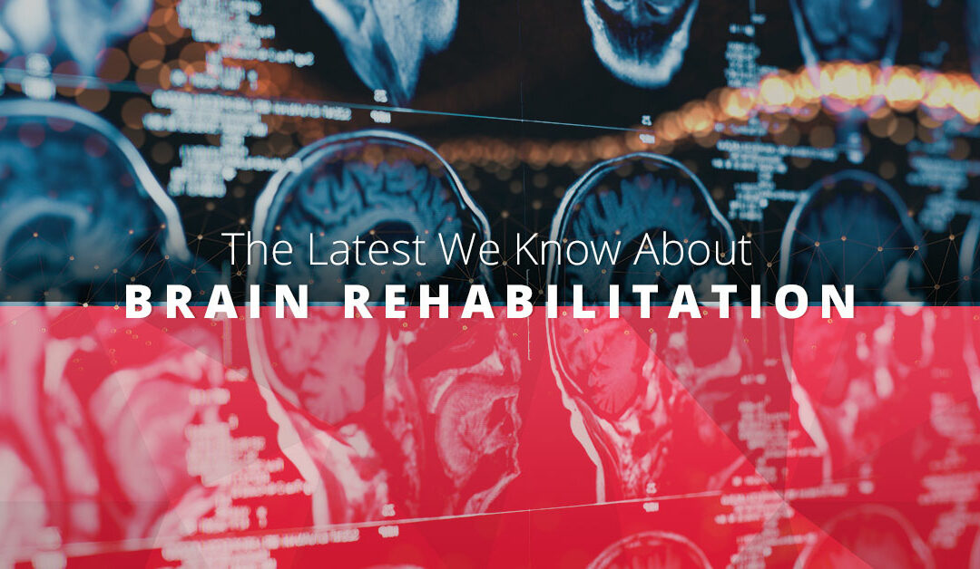 The Latest We Know About Brain Rehabilitation